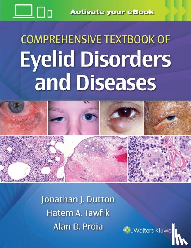 Dutton, Jonathan, MD, PhD, Proia, Alan, Tawfik, Hatem - Comprehensive Textbook of Eyelid Disorders and Diseases