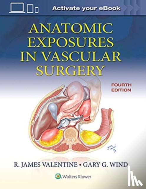 Valentine, R. James, Wind, Gary G. - Anatomic Exposures in Vascular Surgery