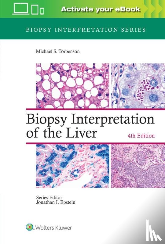Torbenson, Michael - Biopsy Interpretation of the Liver