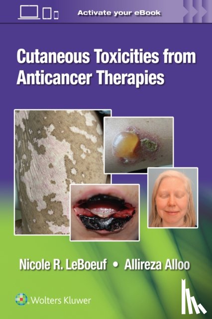 LeBoeuf, Dr. Nicole, Alloo, Dr. Allireza - Cutaneous Toxicities from Anticancer Therapies