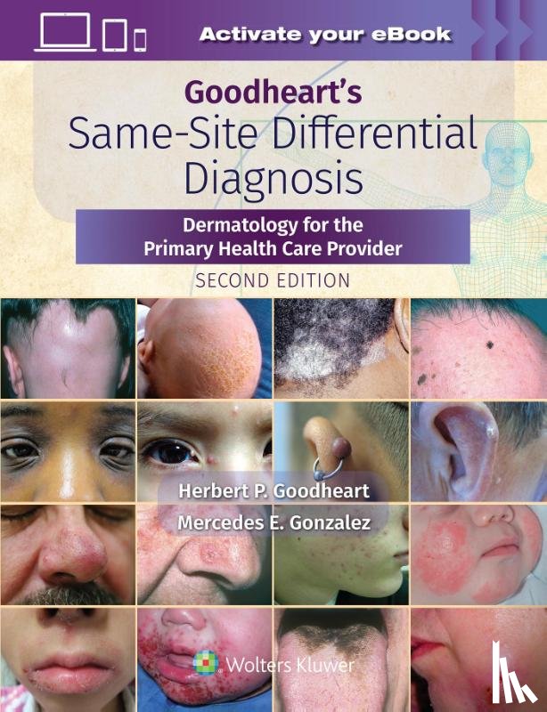 Goodheart, Herbert - Goodheart's Same-Site Differential Diagnosis