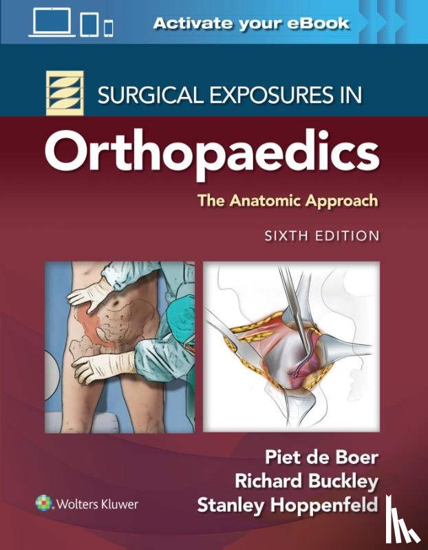de Boer, Dr. Piet, MD, Buckley, Richard, MD, FRCSC, Hoppenfeld, Stanley - Surgical Exposures in Orthopaedics: The Anatomic Approach