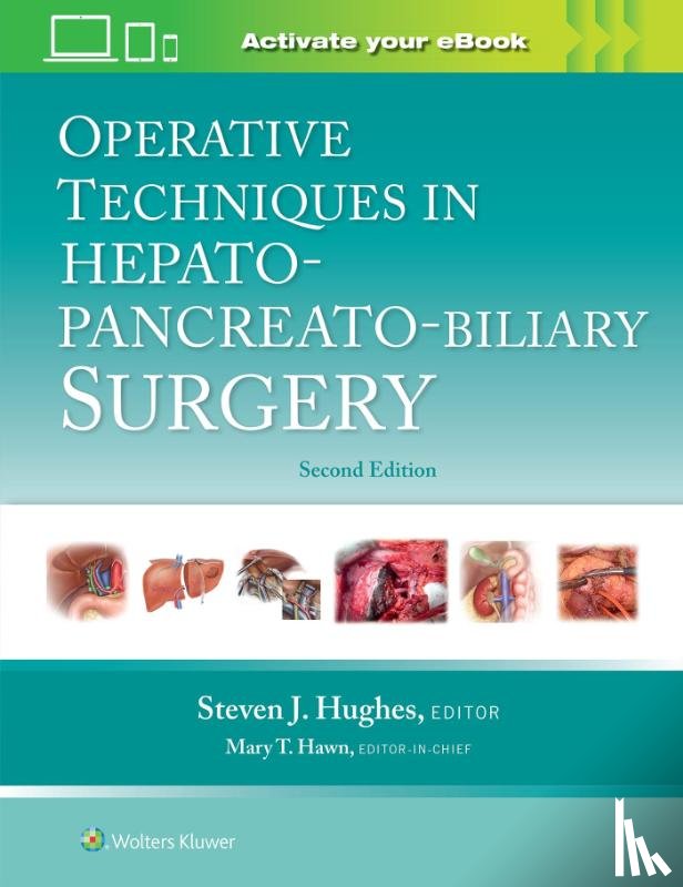  - Operative Techniques in Hepato-Pancreato-Biliary Surgery: Print + eBook with Multimedia
