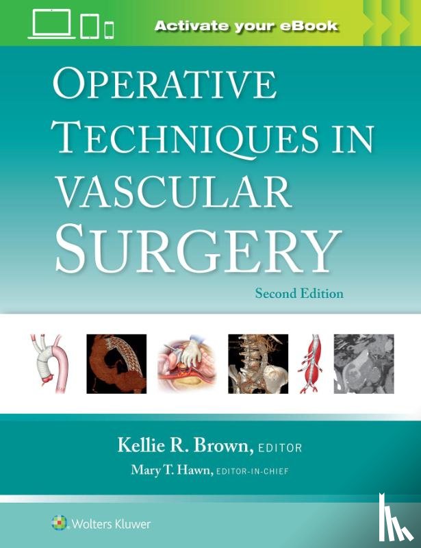  - Operative Techniques in Vascular Surgery: Print + eBook with Multimedia