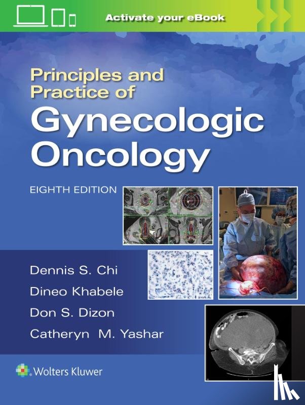 CHI, DENNIS, Berchuck, Andrew, Dizon, Don S., Yashar, Catheryn M. - Principles and Practice of Gynecologic Oncology