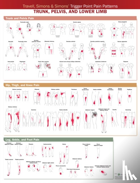  - Travell, Simons & Simons’ Trigger Point Pain Patterns Wall Chart