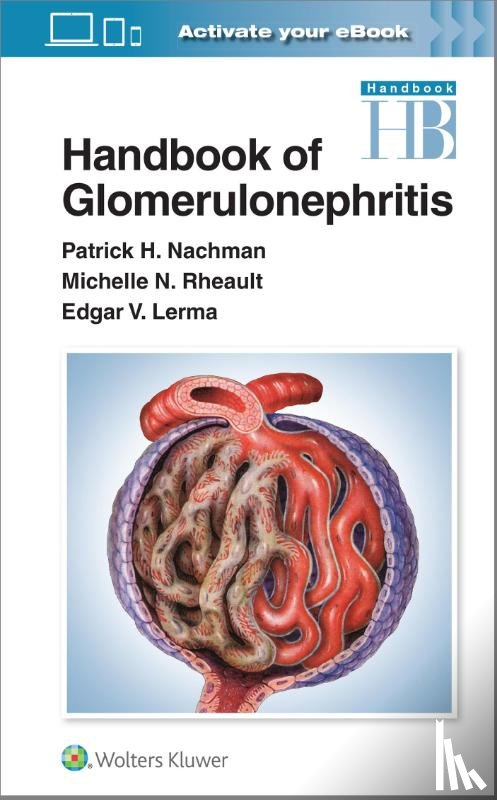 Nachman, Patrick Henry, Lerma, Edgar, Rheault, Michelle - Handbook of Glomerulonephritis