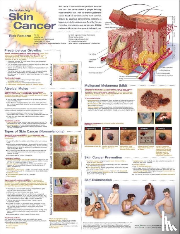  - Understanding Skin Cancer Anatomical Chart