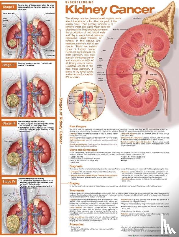  - Understanding Kidney Cancer Anatomical Chart