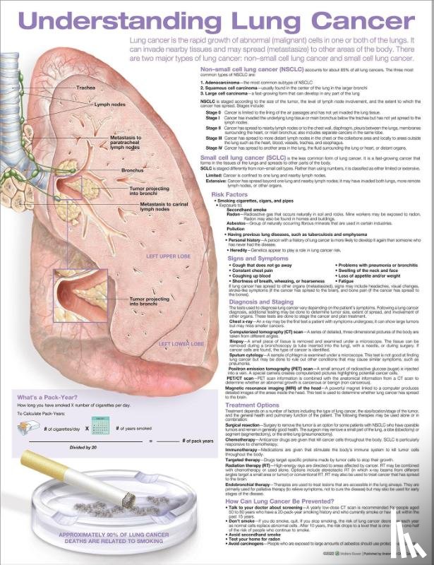 - Understanding Lung Cancer Anatomical Chart