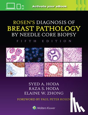 Hoda, Syed A., Hoda, Raza S., Zhong, Elaine - Rosen's Diagnosis of Breast Pathology by Needle Core Biopsy