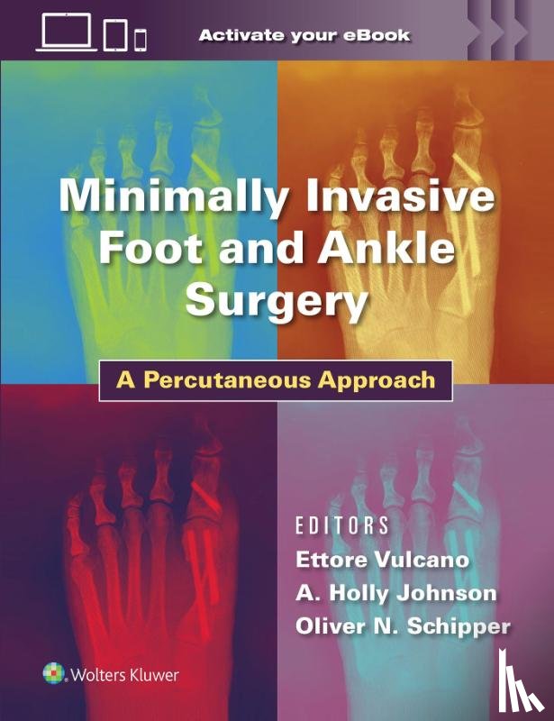 Vulcano, Dr. Ettore, Johnson, A. Holland, Schipper, Oliver - Minimally Invasive Foot and Ankle Surgery