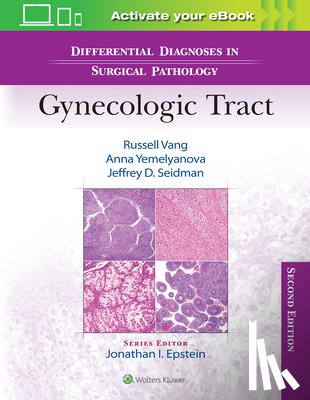 Vang, Russell, Yemelyanova, Anna, Seidman, Jeffrey D. - Differential Diagnoses in Surgical Pathology: Gynecologic Tract