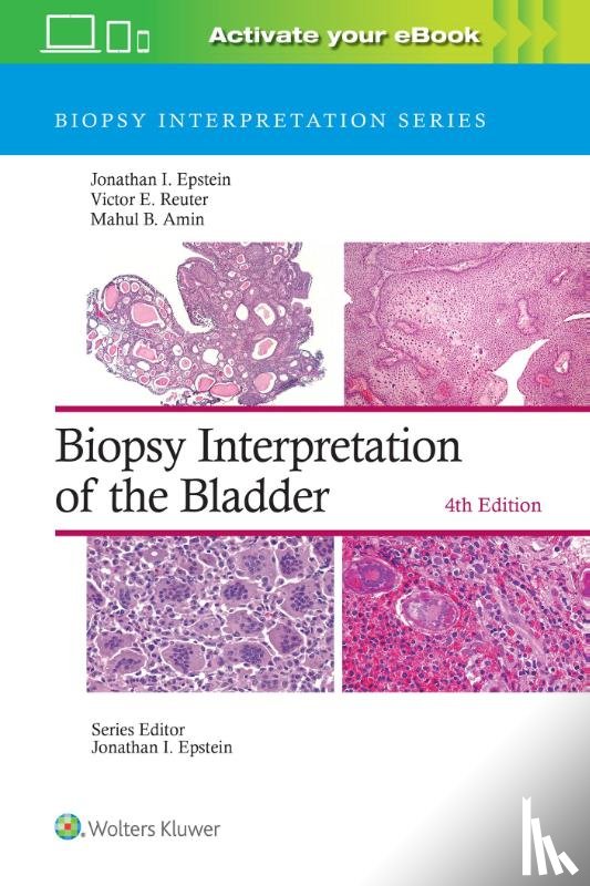 Epstein, Jonathan I., Reuter, Victor E., Amin, Mahul B. - Biopsy Interpretation of the Bladder: Print + eBook with Multimedia