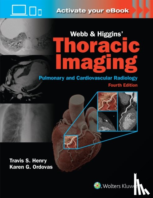 Henry, Travis Scott, ORDOVAS, KAREN GOMES - Webb & Higgins Thoracic Imaging: Print + eBook with Multimedia