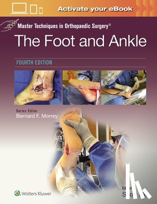 Ellis, Scott - Master Techniques in Orthopaedic Surgery: The Foot and Ankle: Print + eBook with Multimedia