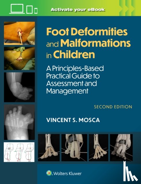 Mosca, Vincent - Foot Deformities and Malformations in Children