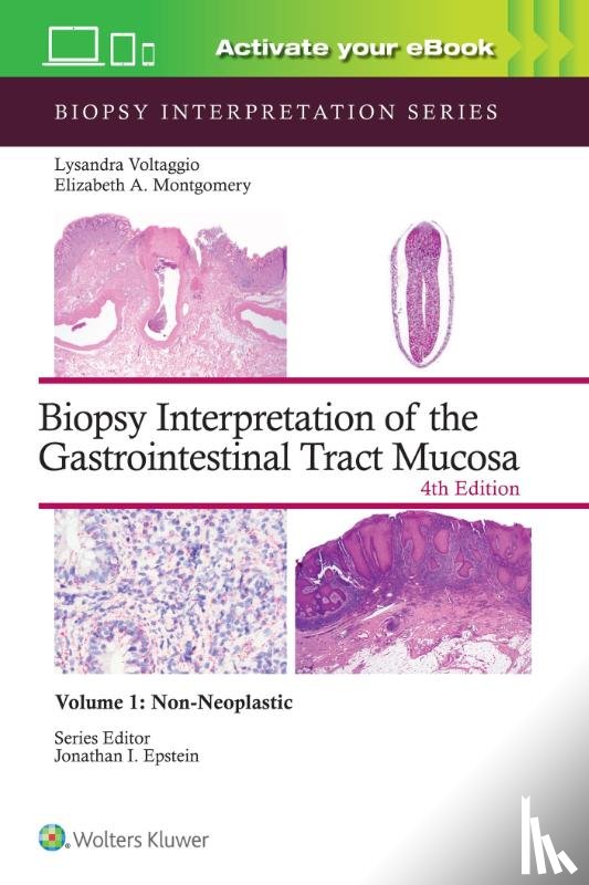 VOLTAGGIO, LYSANDRA, MONTGOMERY, ELIZABETH ANNE - Biopsy Interpretation of the Gastrointestinal Tract Mucosa Volume 1