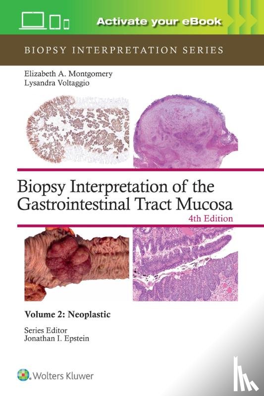 MONTGOMERY, ELIZABETH ANNE, VOLTAGGIO, LYSANDRA - Biopsy Interpretation of the Gastrointestinal Tract Mucosa Volume 2