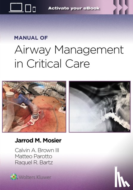 Mosier, Jarrod, Brown, Calvin A, Parotto, Matteo, Bartz, Raquel Rae - Manual of Airway Management in Critical Care: Print + eBook with Multimedia