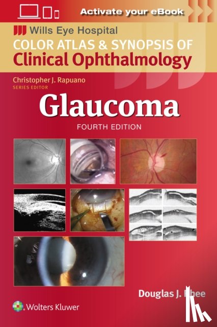 Rhee, Douglas J. - Glaucoma