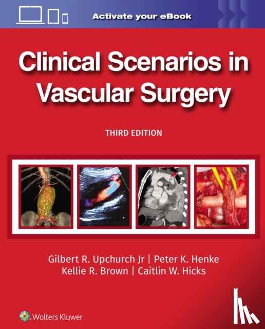 UPCHURCH, GILBERT R., HENKE, PETER, Brown, Kellie R., Hicks, Caitlin Whitney - Clinical Scenarios in Vascular Surgery