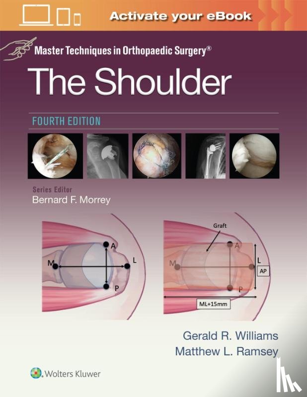 WILLIAMS, GERALD R., RAMSEY, MATTHEW L. - Master Techniques in Orthopaedic Surgery: The Shoulder: Print + eBook with Multimedia