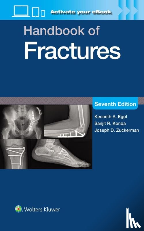 EGOL, KENNETH A. - Handbook of Fractures: Print + eBook with Multimedia