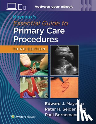 MAYEAUX, EDWARD JOHN, BORNEMANN, PAUL, SEIDENBERG, PETER H. - Mayeaux's Essential Guide to Primary Care Procedures: Print + eBook with Multimedia