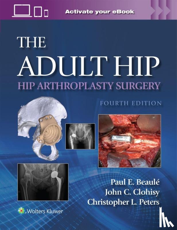 BEAULE, PAUL E., Peters, Christopher L., CLOHISY, JOHN C. - The Adult Hip: Hip Arthroplasty Surgery Print + eBook with Multimedia