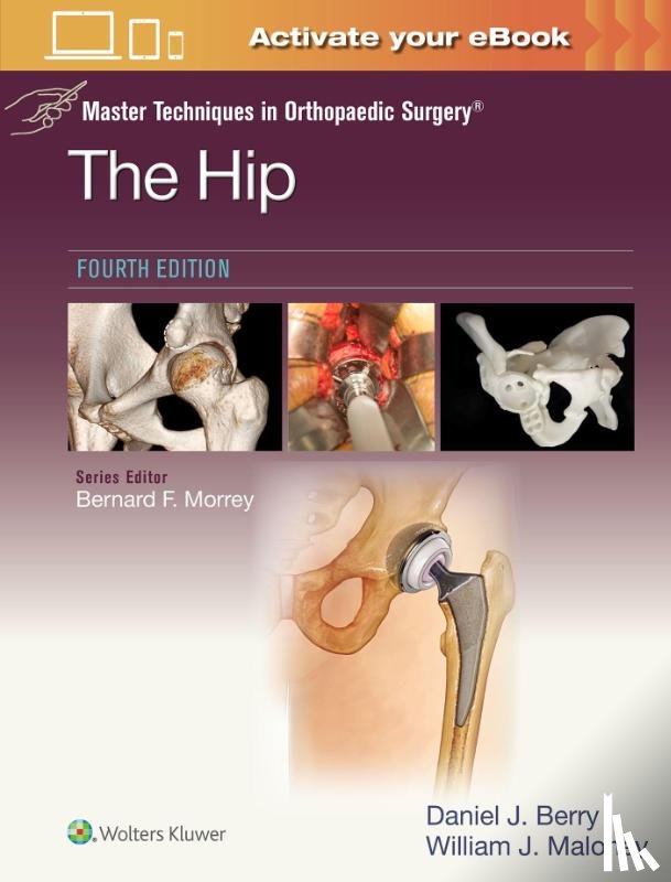 BERRY, DANIEL JOHN, MALONEY, WILLIAM JOSEPH - Master Techniques in Orthopaedic Surgery: The Hip: Print + eBook with Multimedia