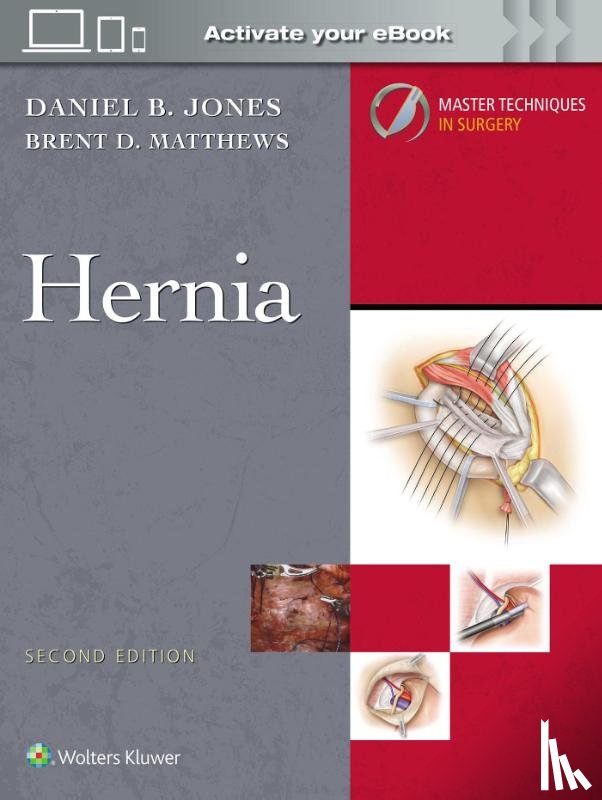 JONES, DANIEL B, Matthews, Brent D. - Master Techniques in Surgery: Hernia: Print + eBook with Multimedia