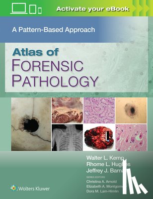 Kemp, Walter L. - Atlas of Forensic Pathology: A Pattern Based Approach: Print + eBook with Multimedia