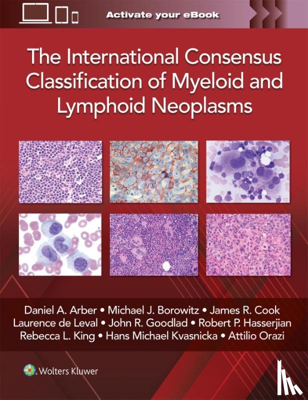 ARBER, DANIEL A. - The International Consensus Classification of Myeloid and Lymphoid Neoplasms