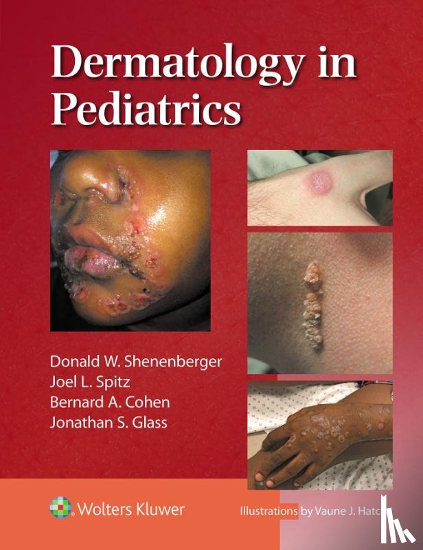 Shenenberger, Donald William, SPITZ, JOEL L. - Dermatology in Pediatrics