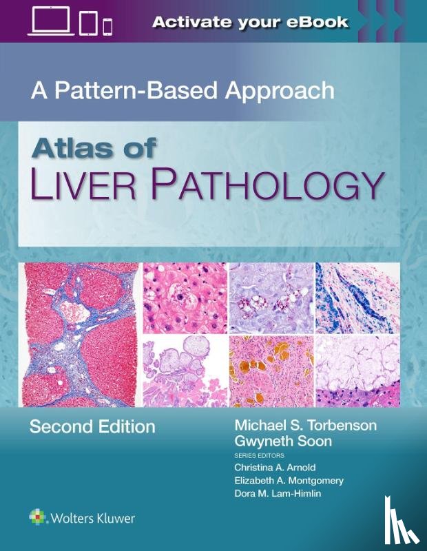 TORBENSON, MICHAEL SCOTT, Soon, Gwyneth - Atlas of Liver Pathology
