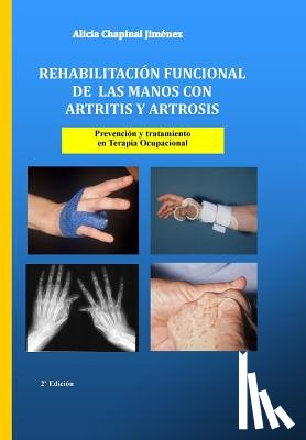 Alicia Chapinal Jiménez - Rehabilitación funcional de las manos con artritis y artrosis: Prevención y tratamiento