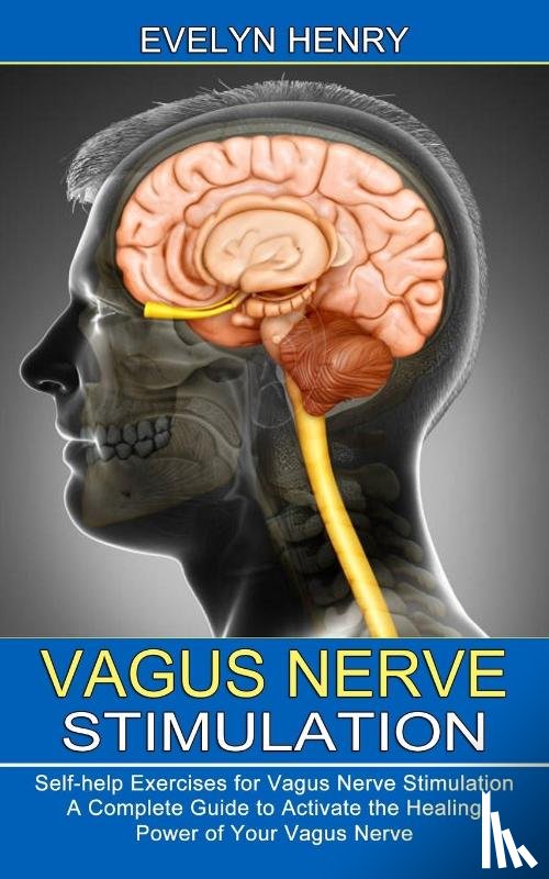 Henry, Evelyn - Vagus Nerve Stimulation