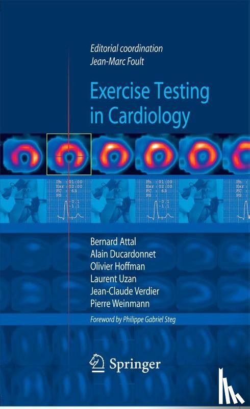 Jean-Marc Foult, Bernard Attal, Alain Ducardonnet, Olivier Hoffman - Exercise testing in cardiology