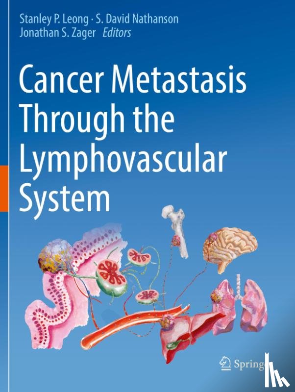  - Cancer Metastasis Through the Lymphovascular System