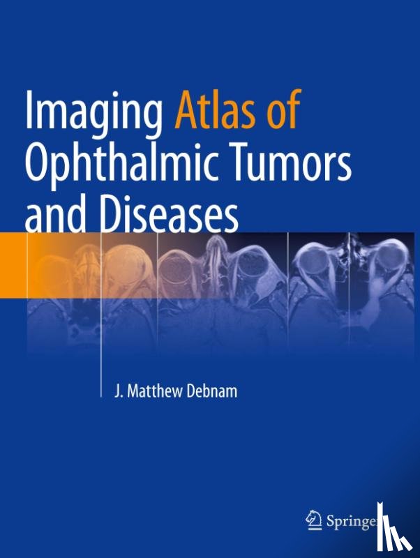  - Imaging Atlas of Ophthalmic Tumors and Diseases
