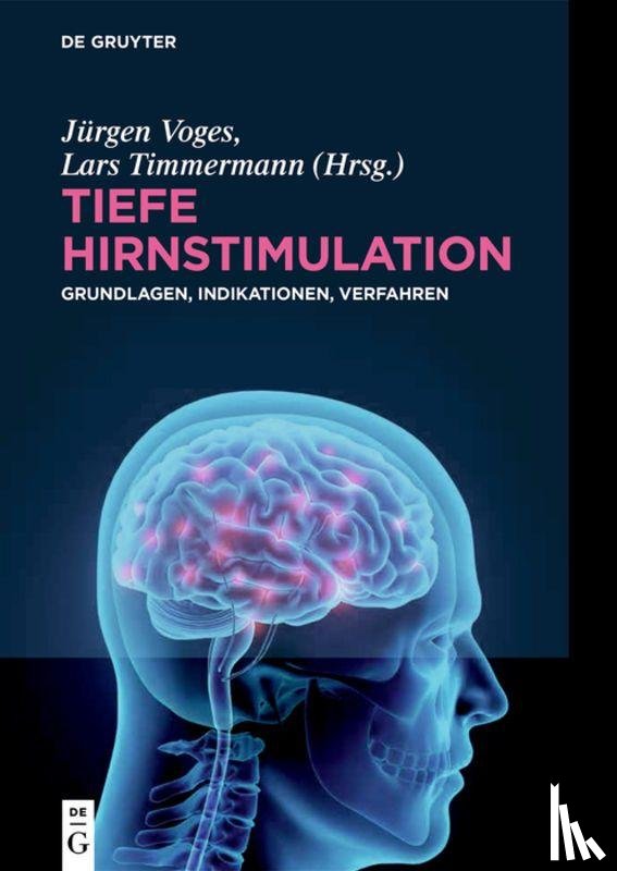  - Tiefe Hirnstimulation