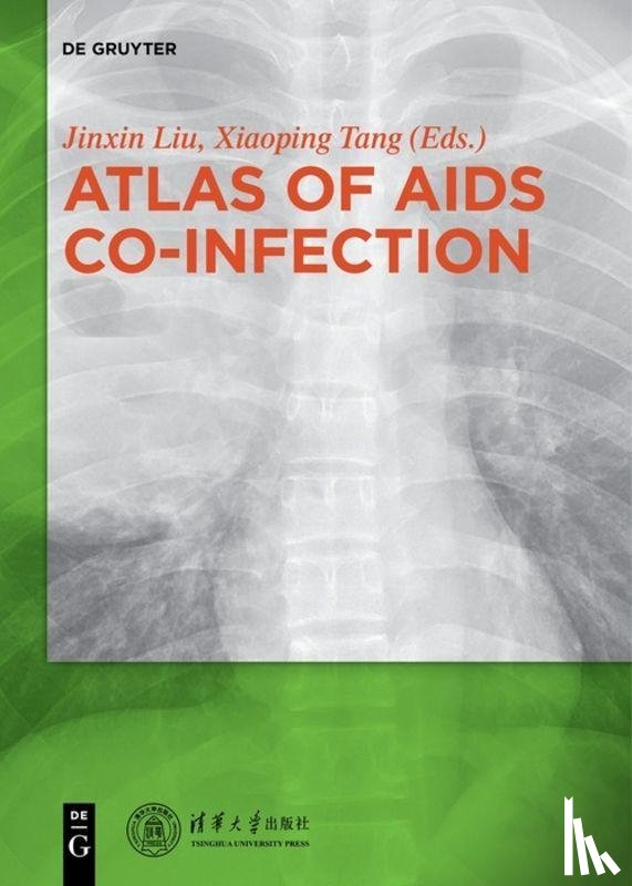  - Atlas of AIDS Co-infection