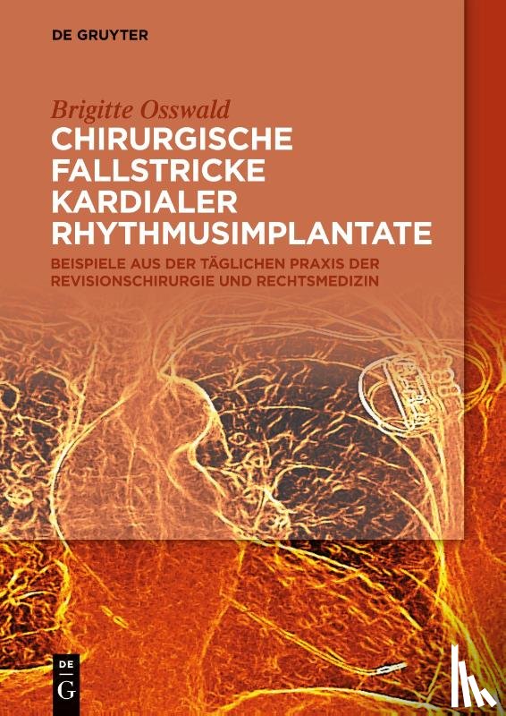 Osswald, Brigitte - Chirurgische Fallstricke kardialer Rhythmusimplantate