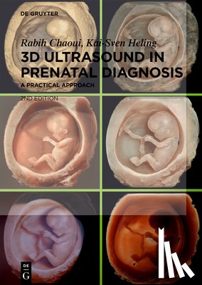 Chaoui, Rabih, Heling, Kai-Sven - 3D Ultrasound in Prenatal Diagnosis