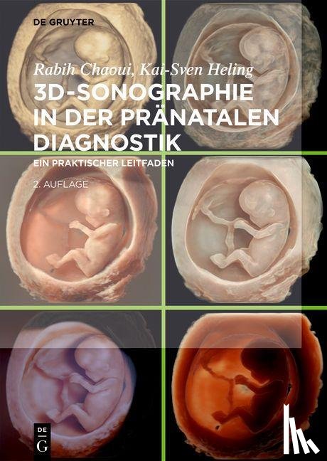 Chaoui, Rabih, Heling, Kai-Sven - 3D-Sonographie in der pränatalen Diagnostik