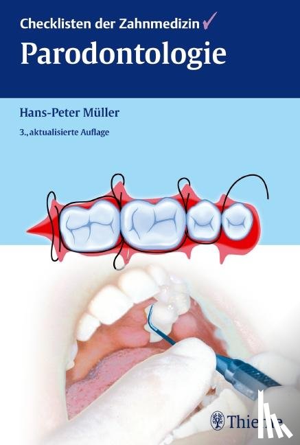Müller, Hans-Peter - Checklisten der Zahnmedizin Parodontologie