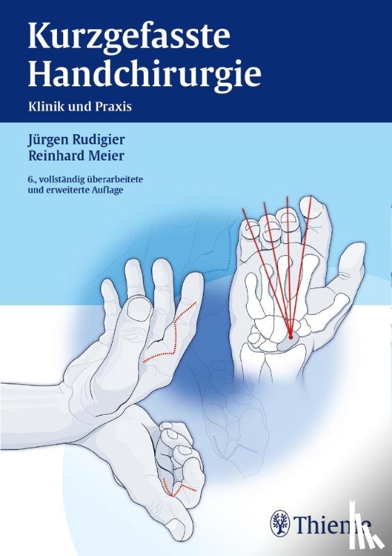 Rudigier, Jürgen, Meier, Reinhard - Kurzgefasste Handchirurgie