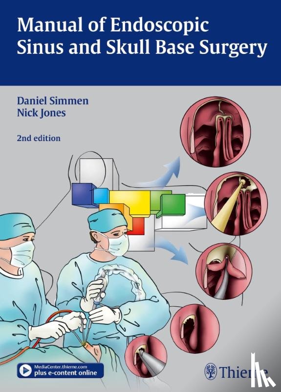  - Manual of Endoscopic Sinus and Skull Base Surgery