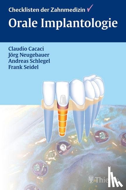 Cacaci, Claudio, Schlegel, Andreas, Neugebauer, Jörg, Seidel, Frank - Checkliste Orale Implantologie
